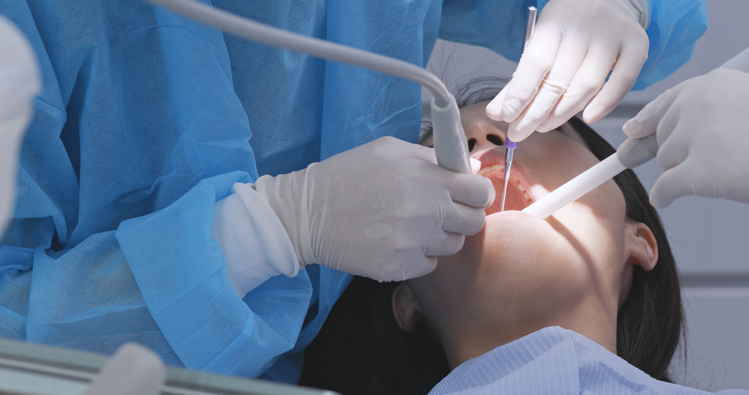 Terapia vectorowa - ultradźwiękowe leczenie periodontologiczne Terapia vectorowa - ultradźwiękowe leczenie periodontologiczne