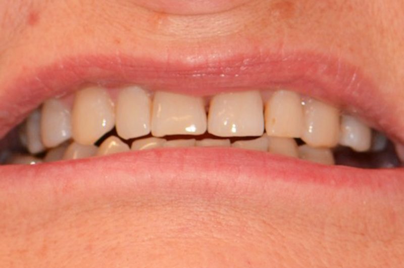 DENTAL CORNER PANI DOROTA PRZED